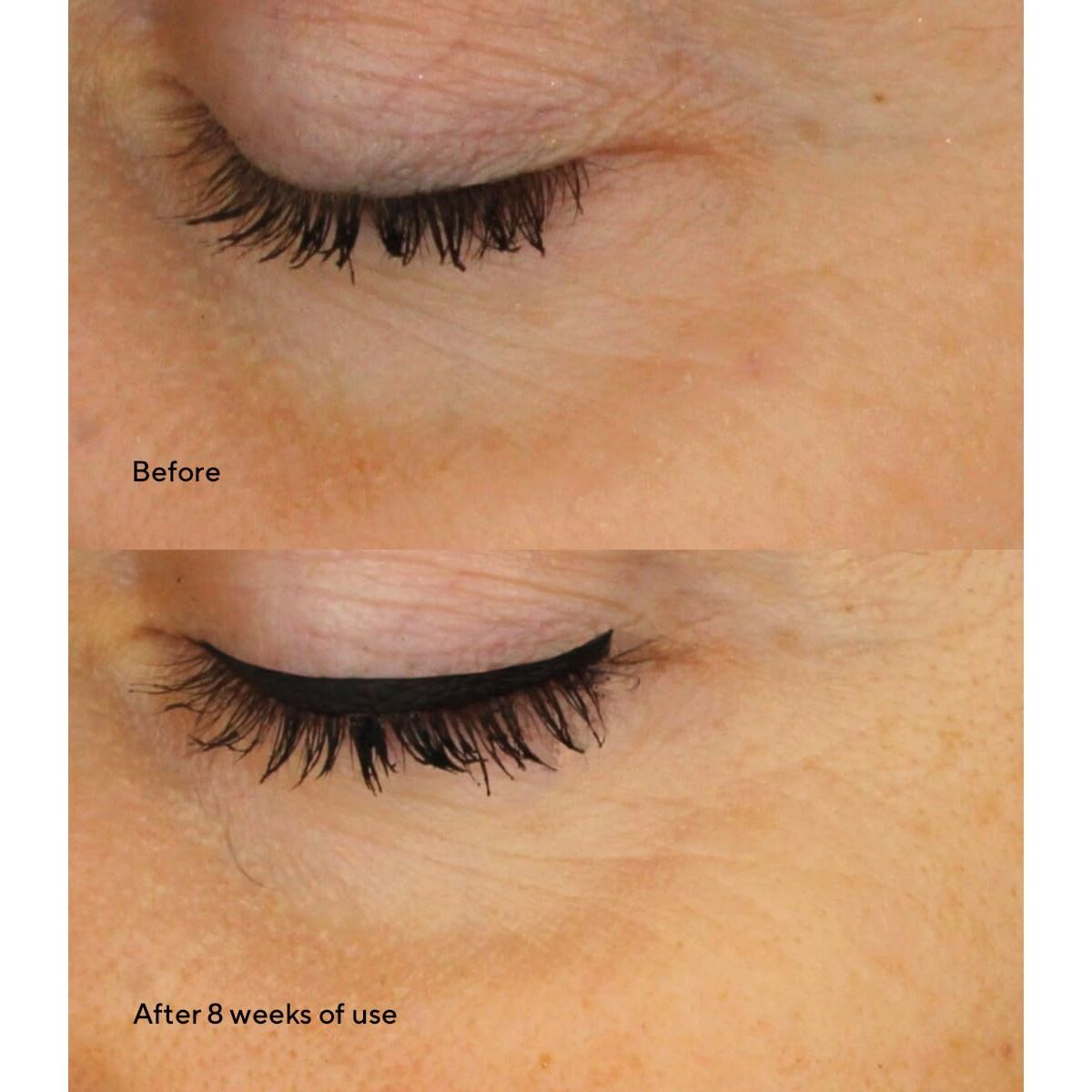 V2HBDC94CBB4E2F08E923FF66159196320ER7787709P9